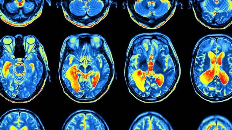 How Complaining Physically Rewires Your Brain For Negativity, Anxiety ...